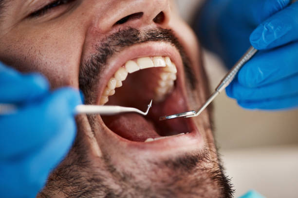 Best Emergency Treatment for Oral Infections in Oakland, NE